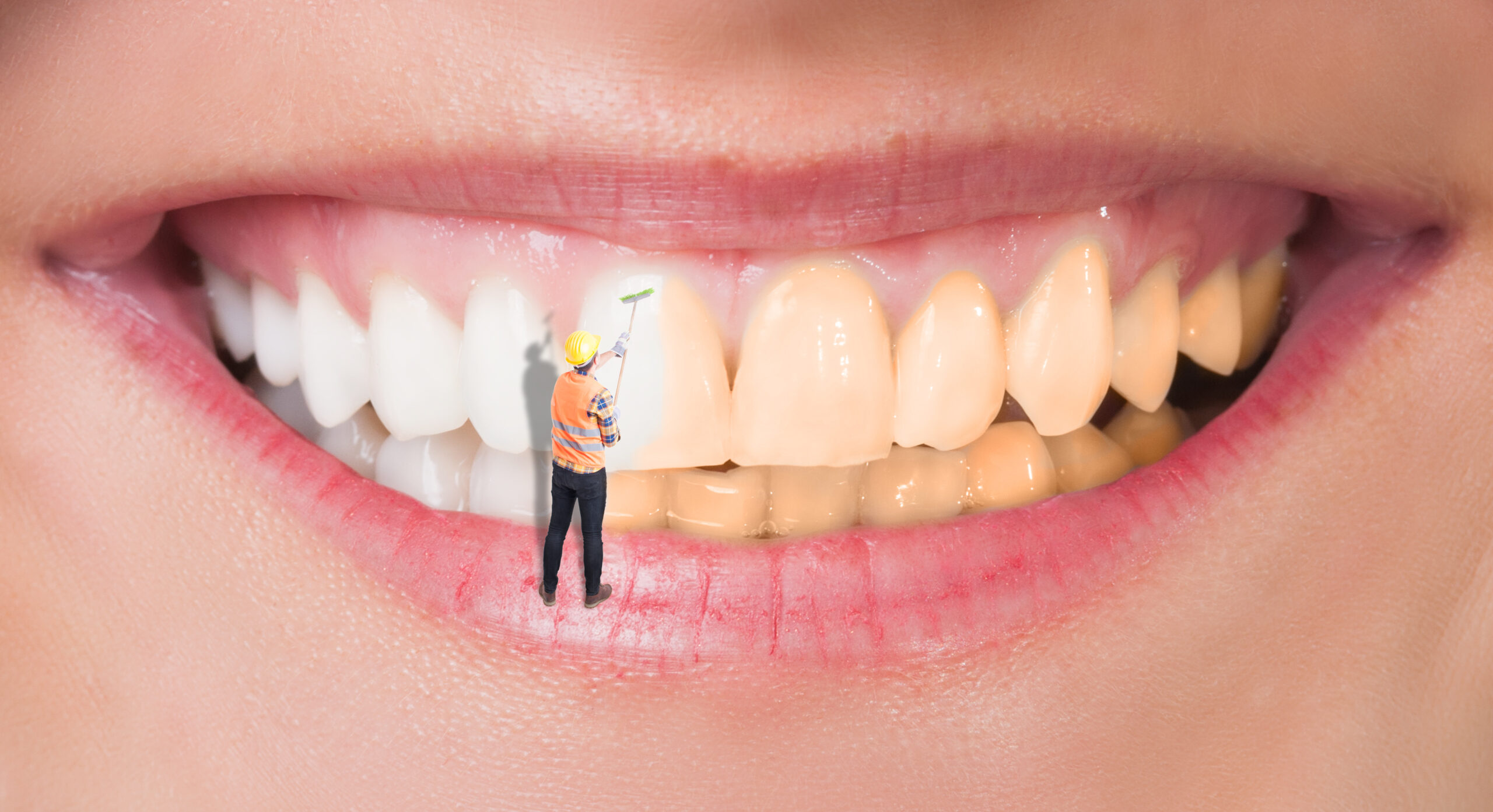 Dental Hygiene