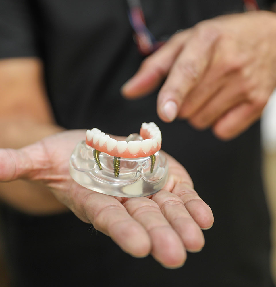 dental implant model