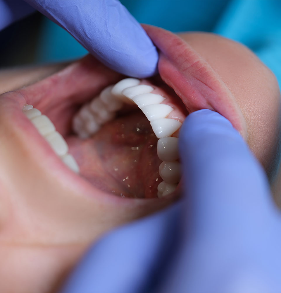 doctor performing oral checkup